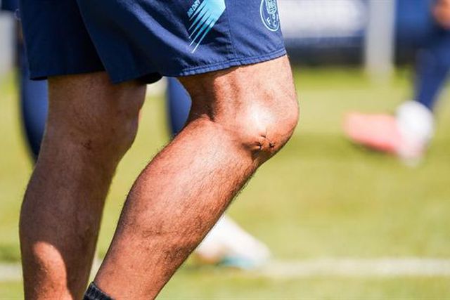 Dragões mostram cicatriz de Conceição: «A todo o custo» (fotos)