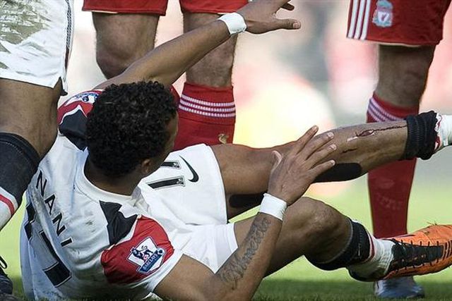 «Sir Alex disse ao Nani: “Espero que tenhas a perna partida!”»