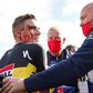 A queda que deixou Evenepoel em sangue (já depois de cortar a meta) - vídeo