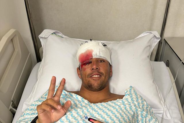 Vasco Ribeiro sofre acidente grave a surfar: «Levei 50 pontos na cara»