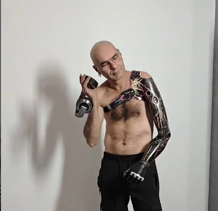 Miky Bionic, 49 anos, perdeu a mão num acidente quando era adolescente. Foto DR