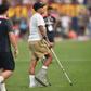 João Simões no Jamor, na final da Taça de Portugal, com o pé protegido e a usar canadianas - Foto: MIGUEL NUNES