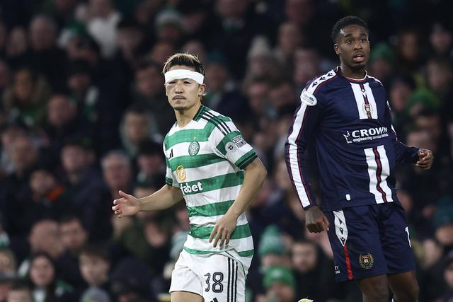 Daizen Maeda já com a lesão no olho sofrida após marcar frente ao Dundee FC