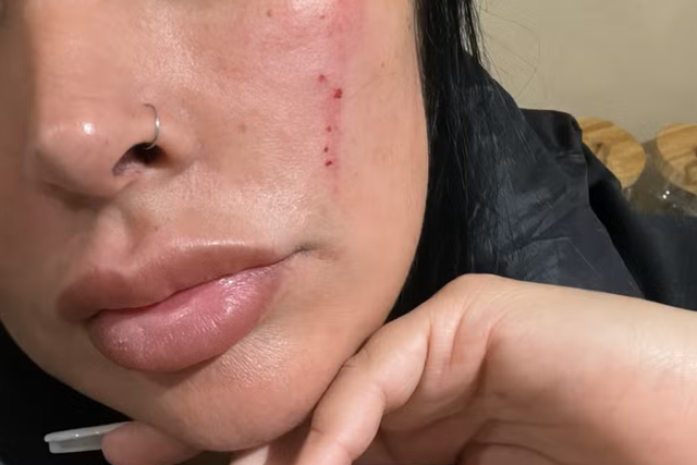 Mulher de ex-Santa Clara revela agressões e xenofobia no Porto