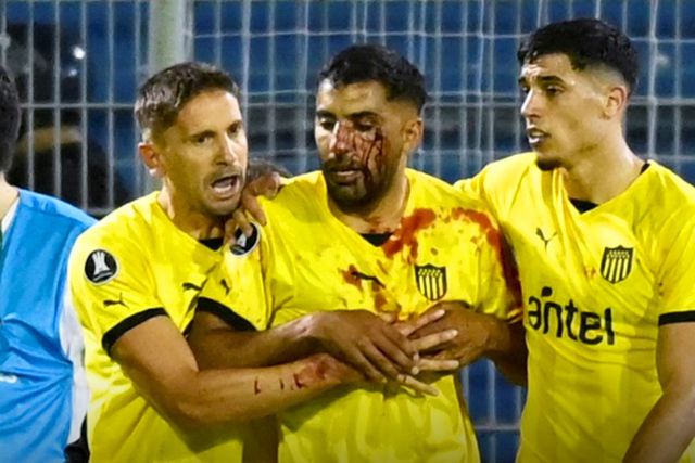 Chocante: jogador do Peñarol leva pedrada em campo e desmaia no balneário (vídeos)