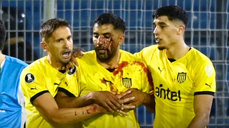 Chocante: jogador do Peñarol leva pedrada em campo e desmaia no balneário (vídeos)