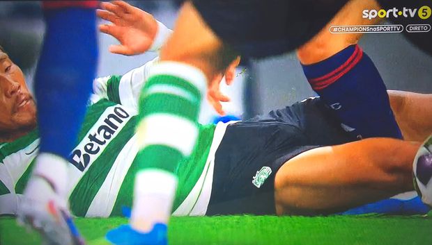 31’: mal mostrado. Incorreto o amarelo a Morita, foi aparato. Ao escorregar e ir a deslizar deu a ideia de que teria acertado de sola em Trossard, mas não há contacto e as pernas passaram lateralmente encaixando a perna do adversário, era só livre direto