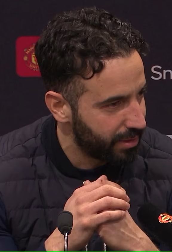 Amorim na conferência de imprensa após o jogo com o Brighton, com corte visível na mão
