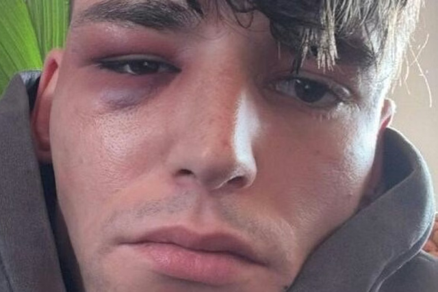 Pascal Kaiser mostra como ficou após novo ataque - Foto: Pascal Kaiser