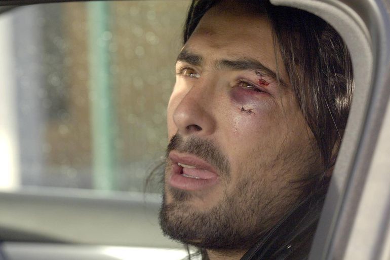 Dudo Aouate mostra as consequências de um murro que levou de Gustabo Munúa, após uma discussão entre os dois guarda-redes do Deportivo em 2008.