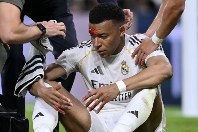 Mbappé com golpe na testa que provocou sangramento