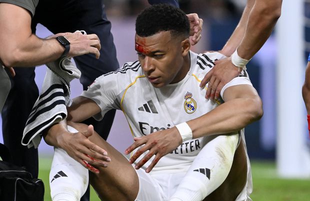 Mbappé com golpe na testa que provocou sangramento
