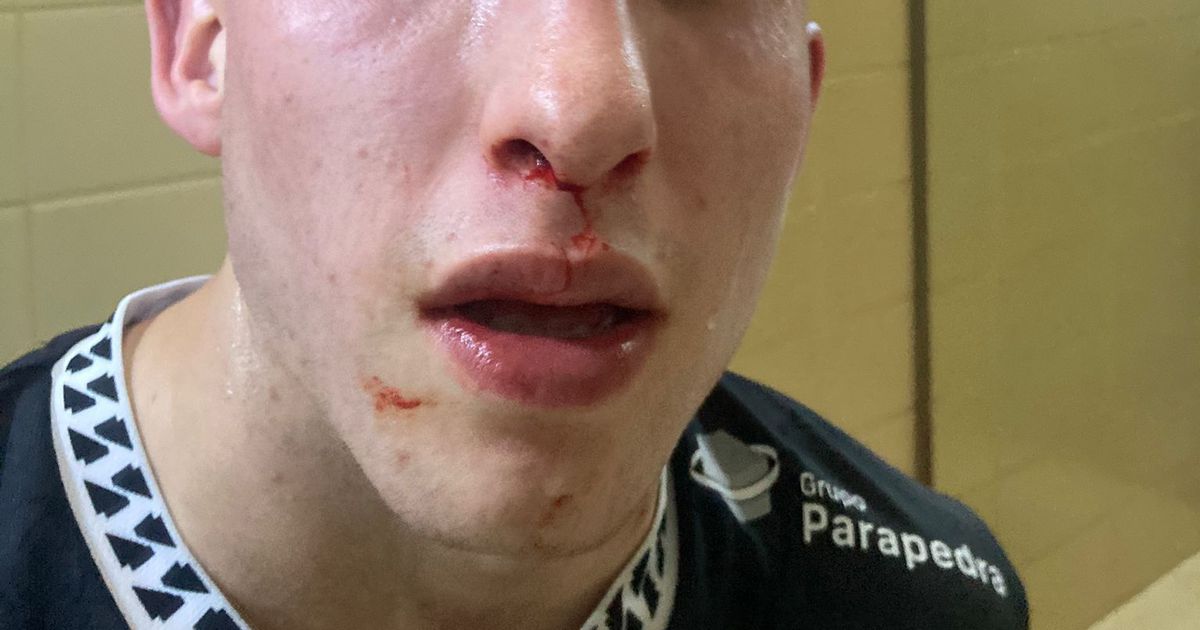 HC Turquel denuncia agressões a jogadores e avança com queixa-crime (fotos)