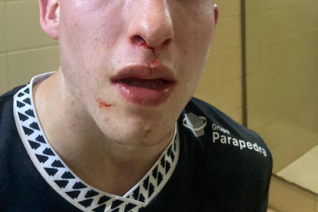HC Turquel denuncia agressões a jogadores e avança com queixa-crime (fotos)