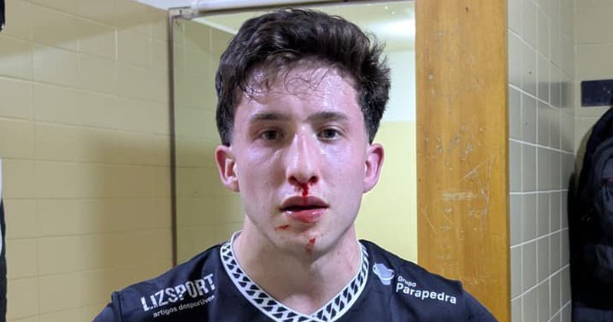 CD Póvoa responde às acusações do HC Turquel em comunicado