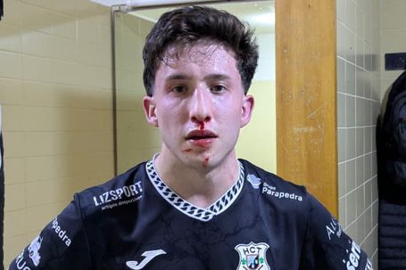 Jogadores do Turquel queixam-se de agressões - Foto: HC Turquel