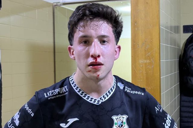 Jogadores do Turquel queixam-se de agressões - Foto: HC Turquel