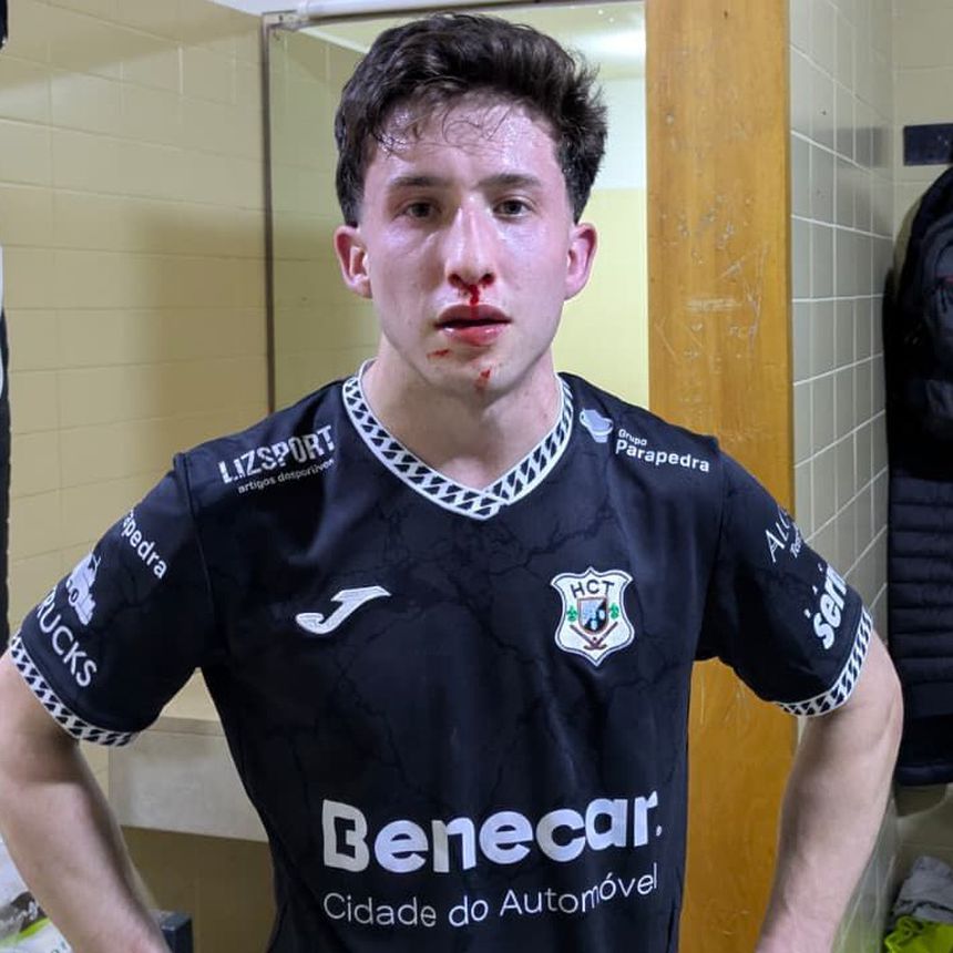 Jogadores do Turquel queixam-se de agressões - Foto: HC Turquel