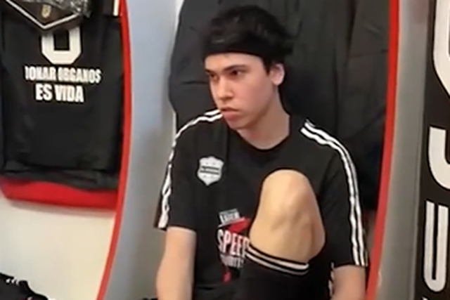 Federação argentina avança com queixa após caso insólito