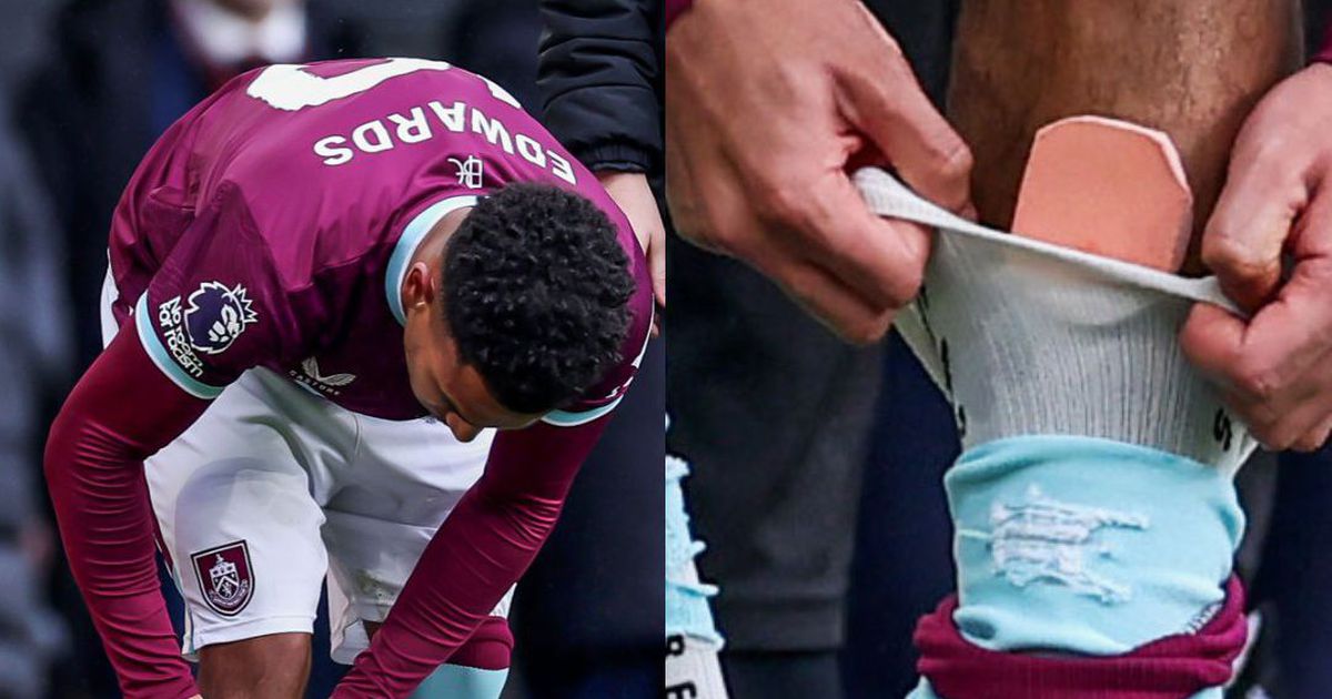 Marcus Edwards brilha em Inglaterra e desperta atenções pelas... caneleiras