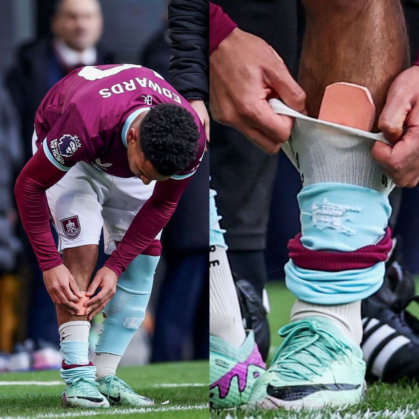 Tamanho das caneleiras de Marcus Edwards em destaque após o jogo com o Crystal Palace
