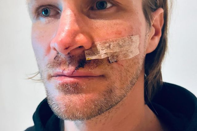 Piloto de motas 'off-road' escapa a armadilha potencialmente mortal