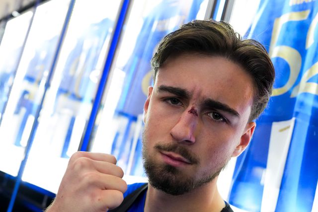 Martim Fernandes com o nariz partido (Foto: FC Porto/X)