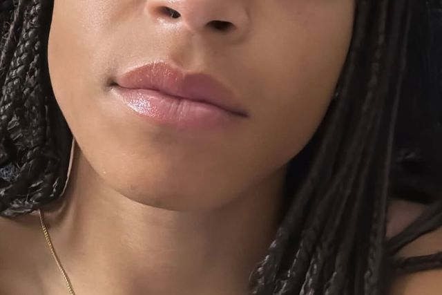 Jéssica Silva partilha novidades após perda de visão