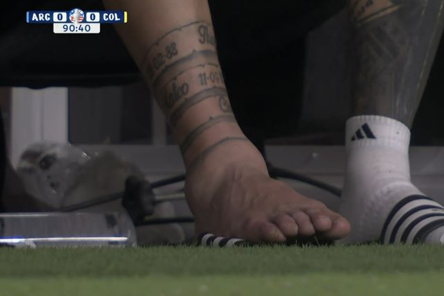 FOTO: a incrível imagem do tornozelo lesionado de Messi
