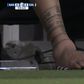 FOTO: a incrível imagem do tornozelo lesionado de Messi