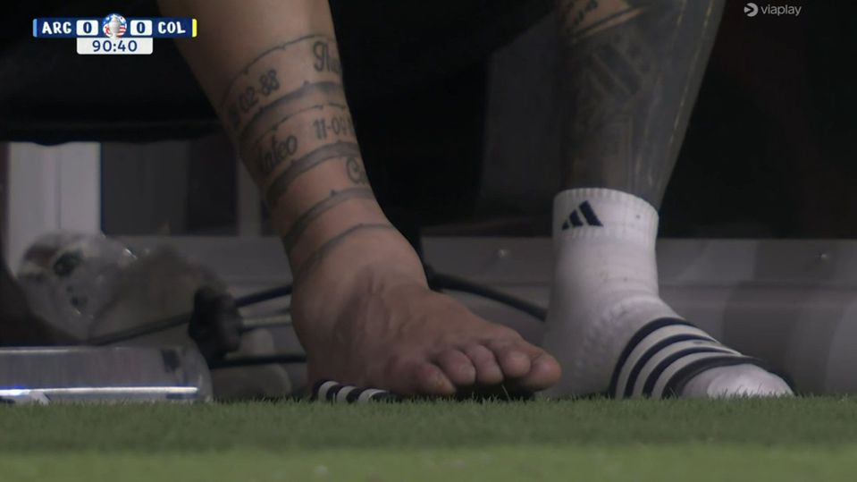 FOTO: a incrível imagem do tornozelo lesionado de Messi