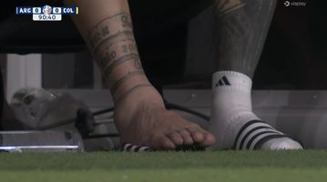 FOTO: a incrível imagem do tornozelo lesionado de Messi