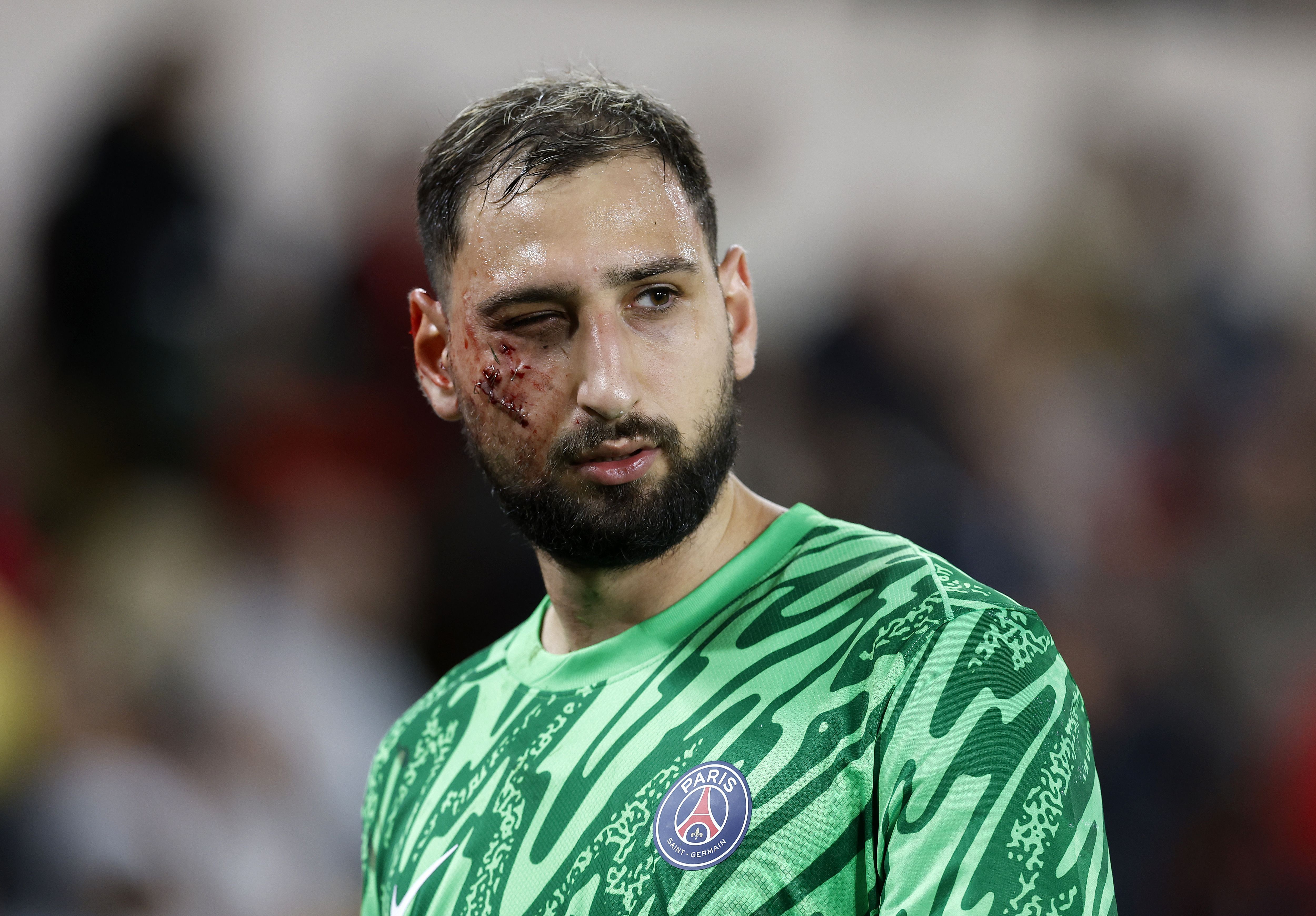 Arrepiante: entrada 'assassina' tira Donnarumma do Mónaco-PSG