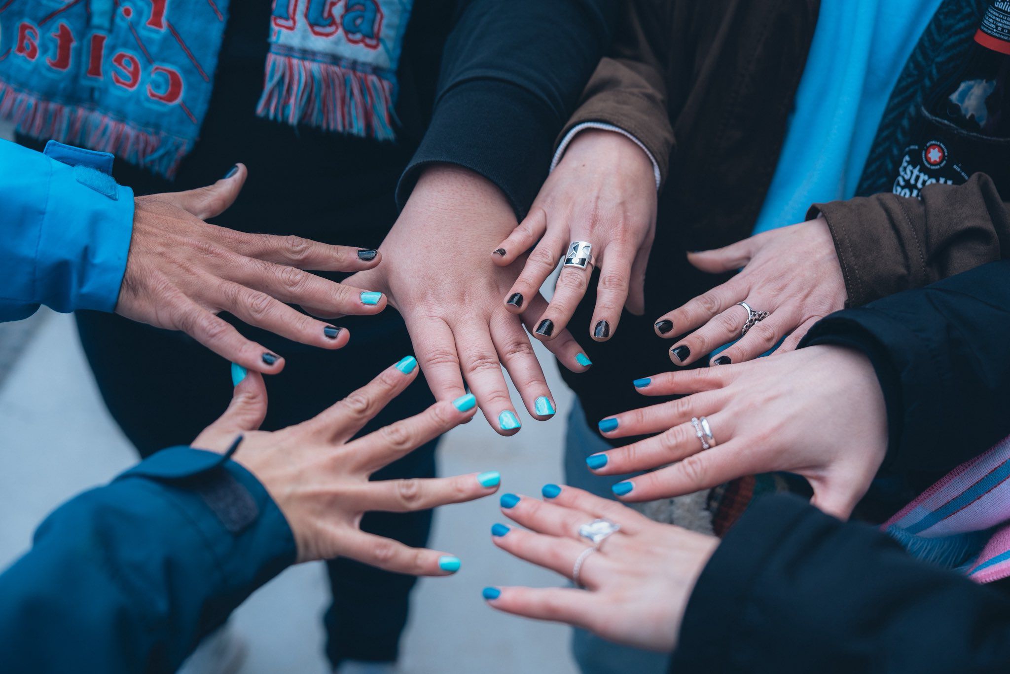 Jogadores e adeptos do Celta com unhas pintadas em apoio a Borja Iglesias - Foto: X/Celta