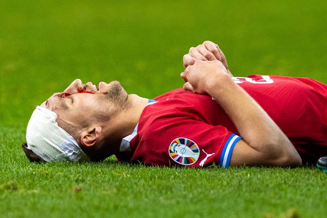 Jogador da Rep. Checa ficou (muito) mal tratado (vídeo)