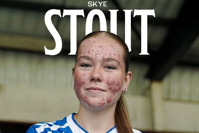 Para Skye (e Gyokeres) é sem limite
