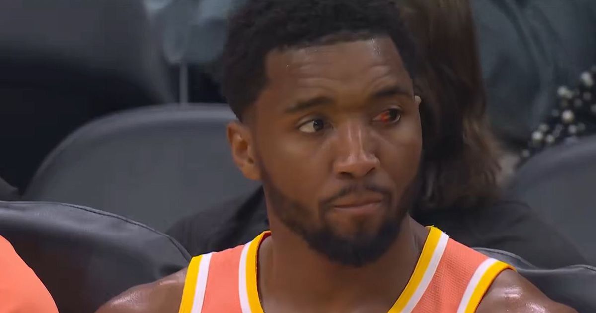 Donovan Mitchell tem o olho assim mas nada o trava: 42 pontos na vitória dos Cavaliers