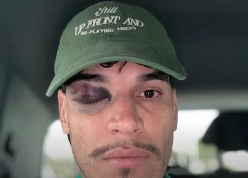 Gómez, do Palmeiras, com olho à Zorro!