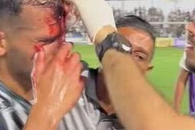 VÍDEO: Foi atingido com lata e podia ter ficado cego