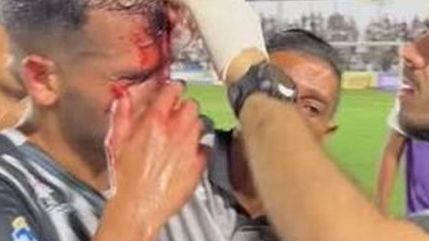 VÍDEO: Foi atingido com lata e podia ter ficado cego