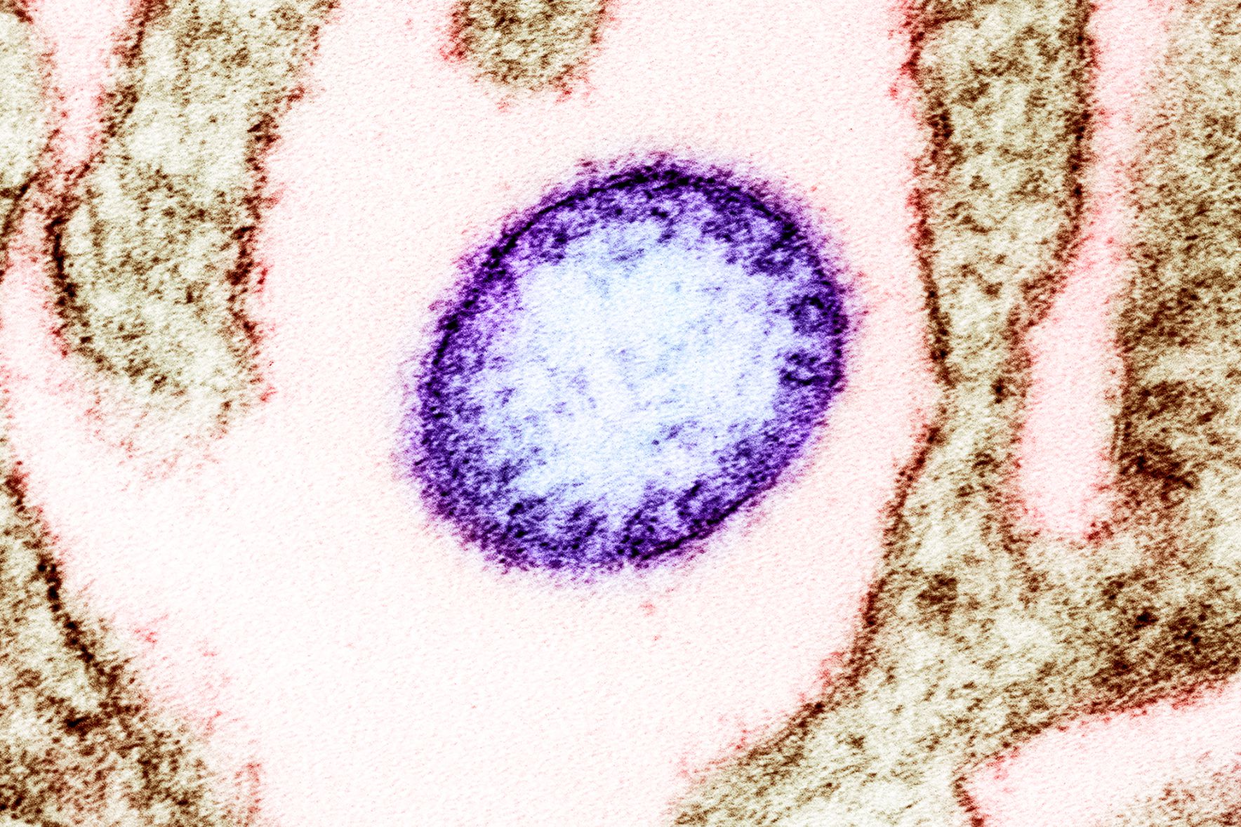 Vírus Nipah - Foto: NIAID