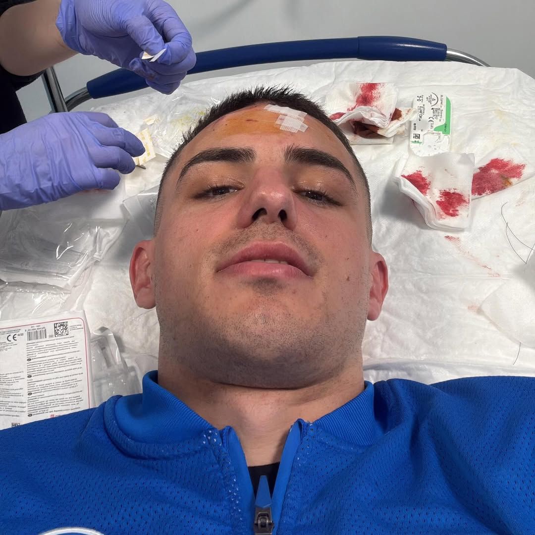 Nikola Krstovic ficou em mau estado depois de atingido por chuteira na testa no Atalanta-Dortmund - Instagram