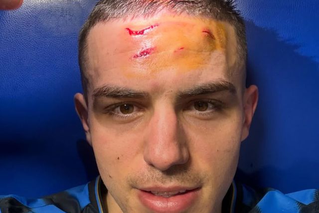 Nikola Krstovic ficou em mau estado depois de atingido por chuteira na testa no Atalanta-Dortmund - Instagram