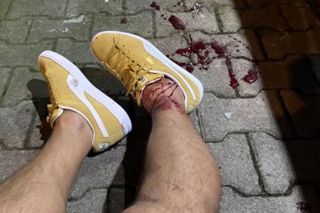 Antigo internacional turco atingido a tiro após comentário televisivo (vídeo)