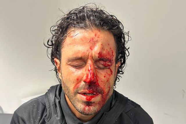 Treinador do Lyon conduzido ao hospital após ataque ao autocarro