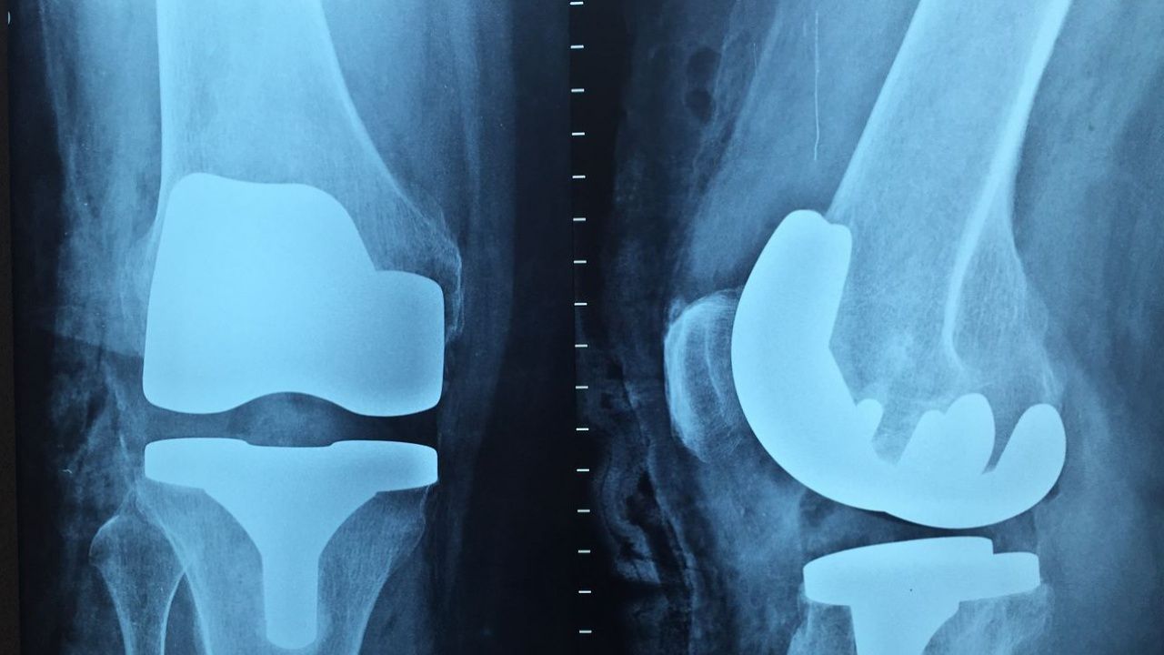 Наши и чужди ортопеди обменят опит в ИСУЛ