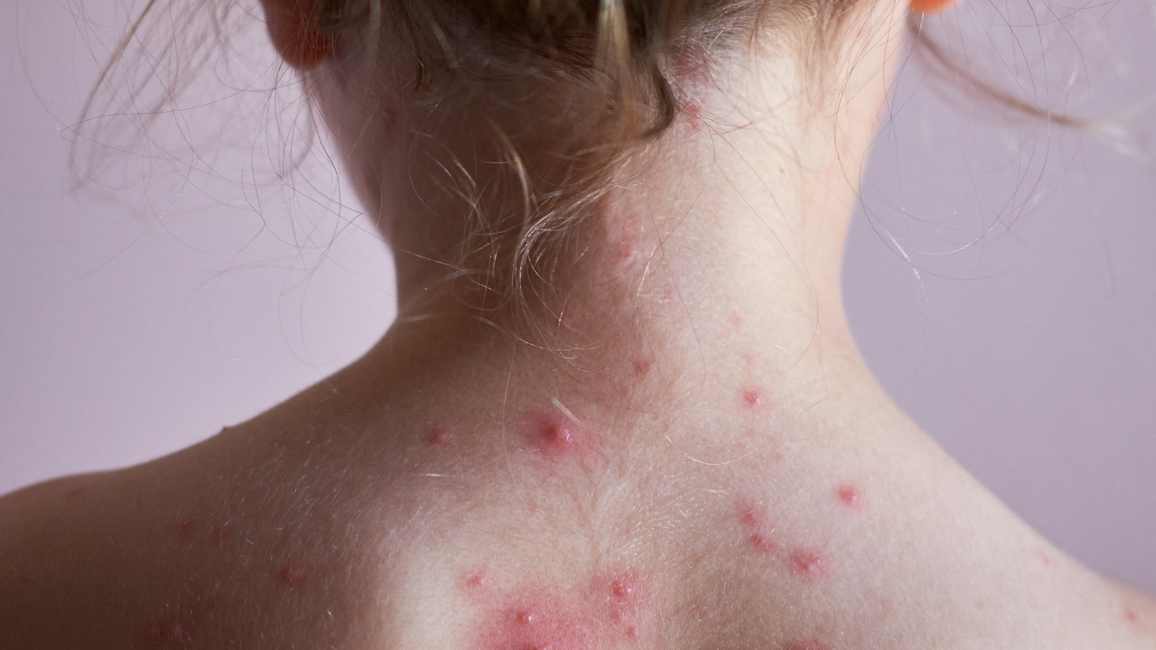 Това е повече от двойно увеличение спрямо средата на ноември,