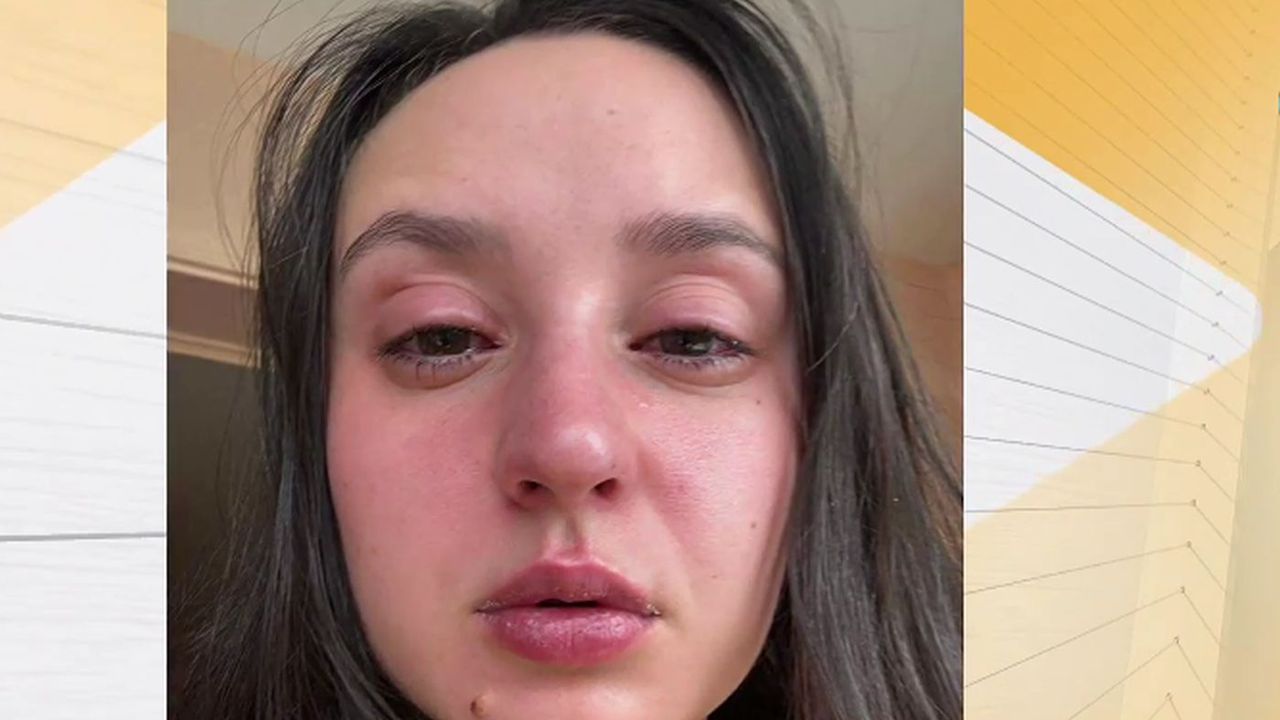 Майка и бебе са с изгаряния заради включена ултравиолетова лампа в Инфекциозна болница в София