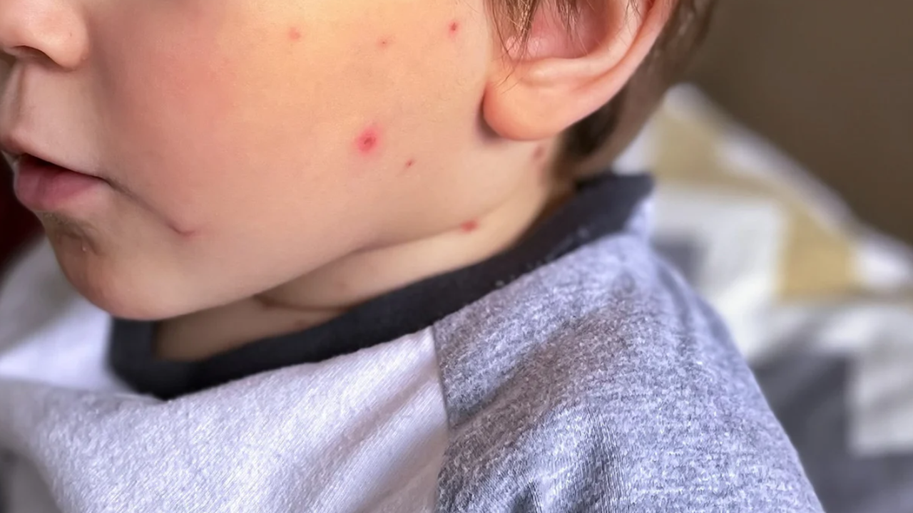 В ефира на предаването Нашият ден по БНР специалистът по