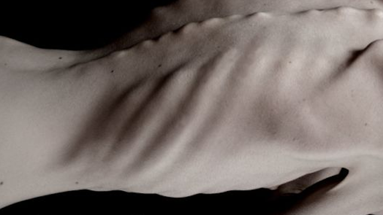 2 500 момичета с анорексия и булимия у нас